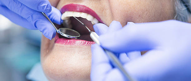 Best Emergency Wisdom Tooth Extraction in Kana, UT